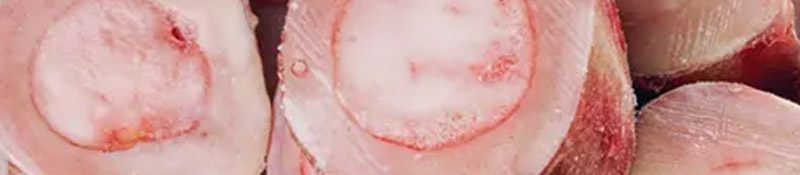 964